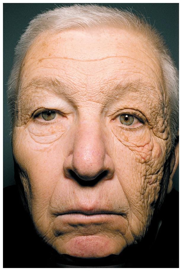 This photo shows what 28 years of sun damage does to your face | The  Independent