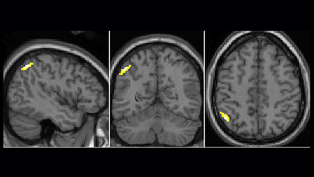 As scientists unlock more of the neurological secrets of the bilingual brain, they're learning that speaking more than one language may have cognitive benefits that extend from childhood into old age.
