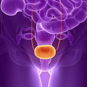 Case Report: Bladder Cancer, age 76, Female