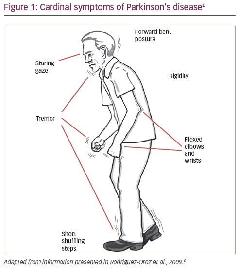 How Can We Reduce The Symptoms Of Parkinson's Disease?, 47% OFF