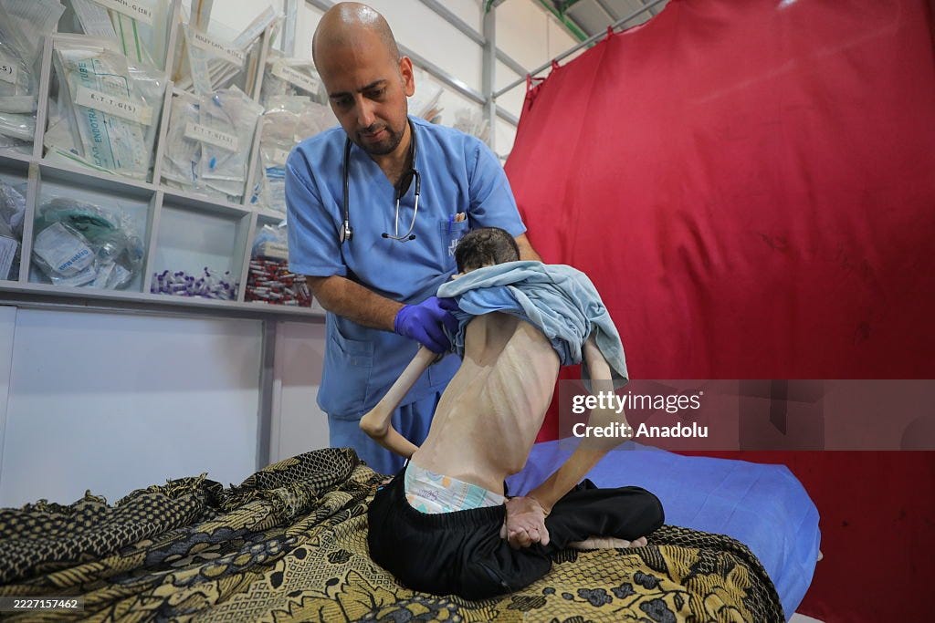 Another Palestinian dies of starvation in Gaza