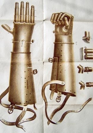 Two illustrations of Götz’s iron hand, one showing the fingers splayed and the others showing them balled into a fist. In addition to the articulated fingers, the metal prosthetic has a cylindrical forearm segment and straps to hold the limb in place.