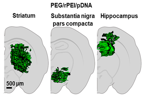 A collage of images of different types of brain cells

AI-generated content may be incorrect.