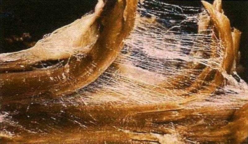 What is Fascia? - Andrew Chick - Structural Bodywork