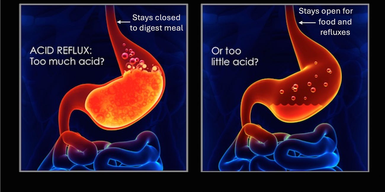 Stomach Acid Is Critical For Health