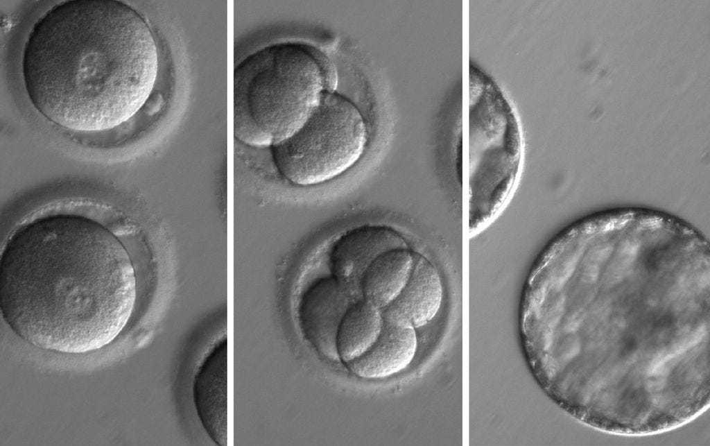 This sequence of images shows the development of embryos after co-injection of a gene-correcting enzyme and sperm from a donor with a genetic mutation known to cause hypertrophic cardiomyopathy.  Credit: Oregon Health and Science University.