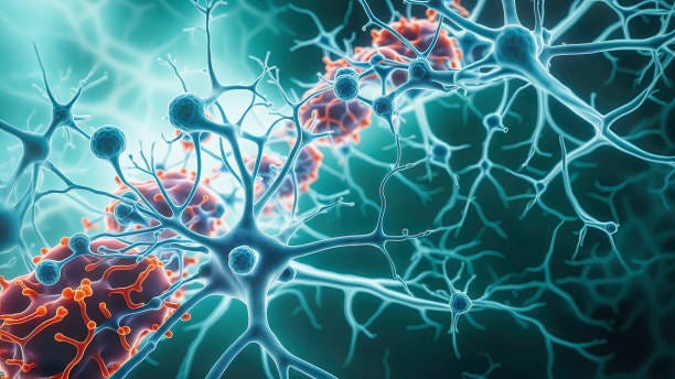 The Dementia Myth: One Of The Biggest Medical Scandals In History