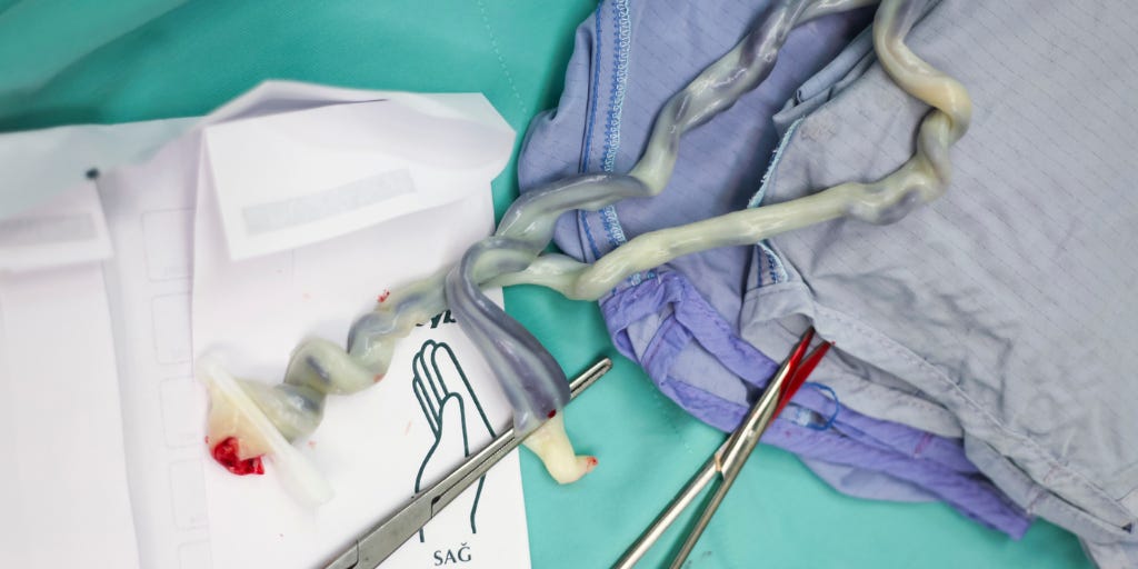 Precision Medicine: The Future of Congenital Heart Disease Care? - Conquering CHD Precision Medicine: The Future of Congenital Heart Disease Care? - Conquering CHD