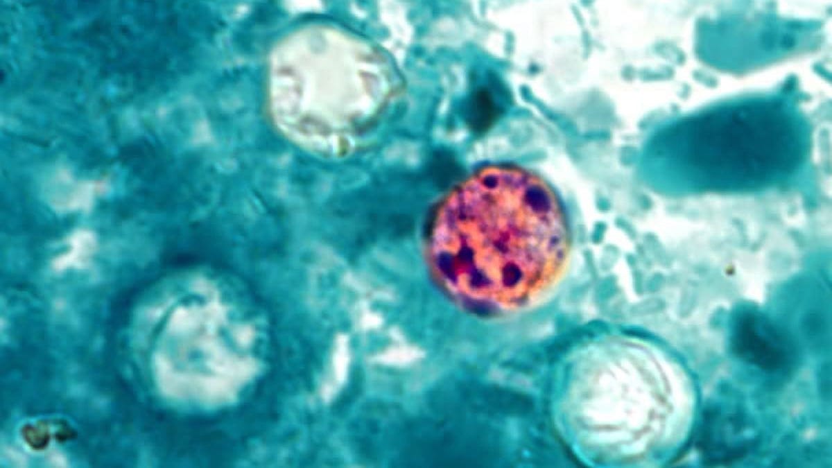 An image showing the cyclospora parasite under a microscope.