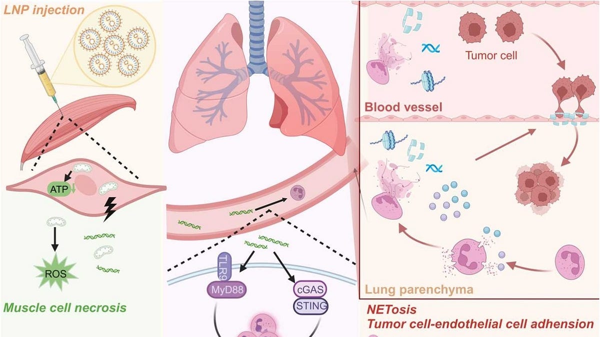 BREAKING: Another mRNA Vaccine Induced Turbo Cancer Mechanism Just Published