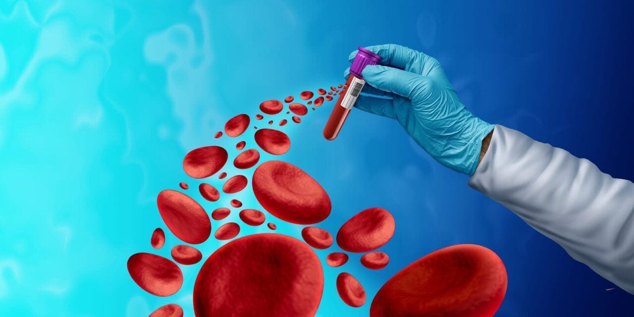AI-Powered Blood Test Shows Promise for Early Lung Cancer Detection | Clinical Lab Products AI-Powered Blood Test Shows Promise for Early Lung Cancer Detection | Clinical Lab Products