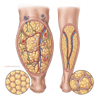 Lipedema Is Not Just Fat: What the Science Really Shows