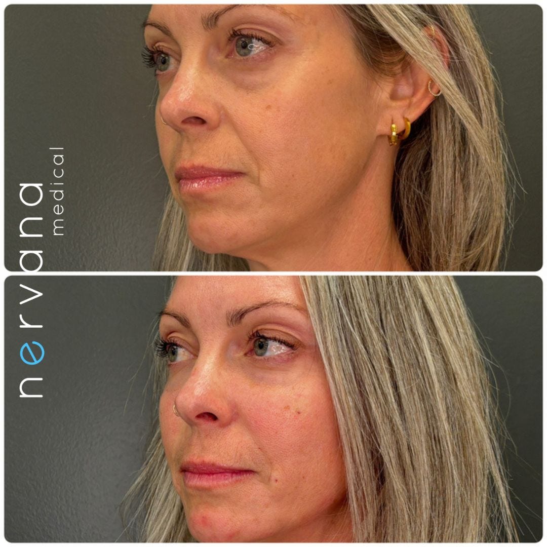 PRF/EZ Gel in Sandy, UT