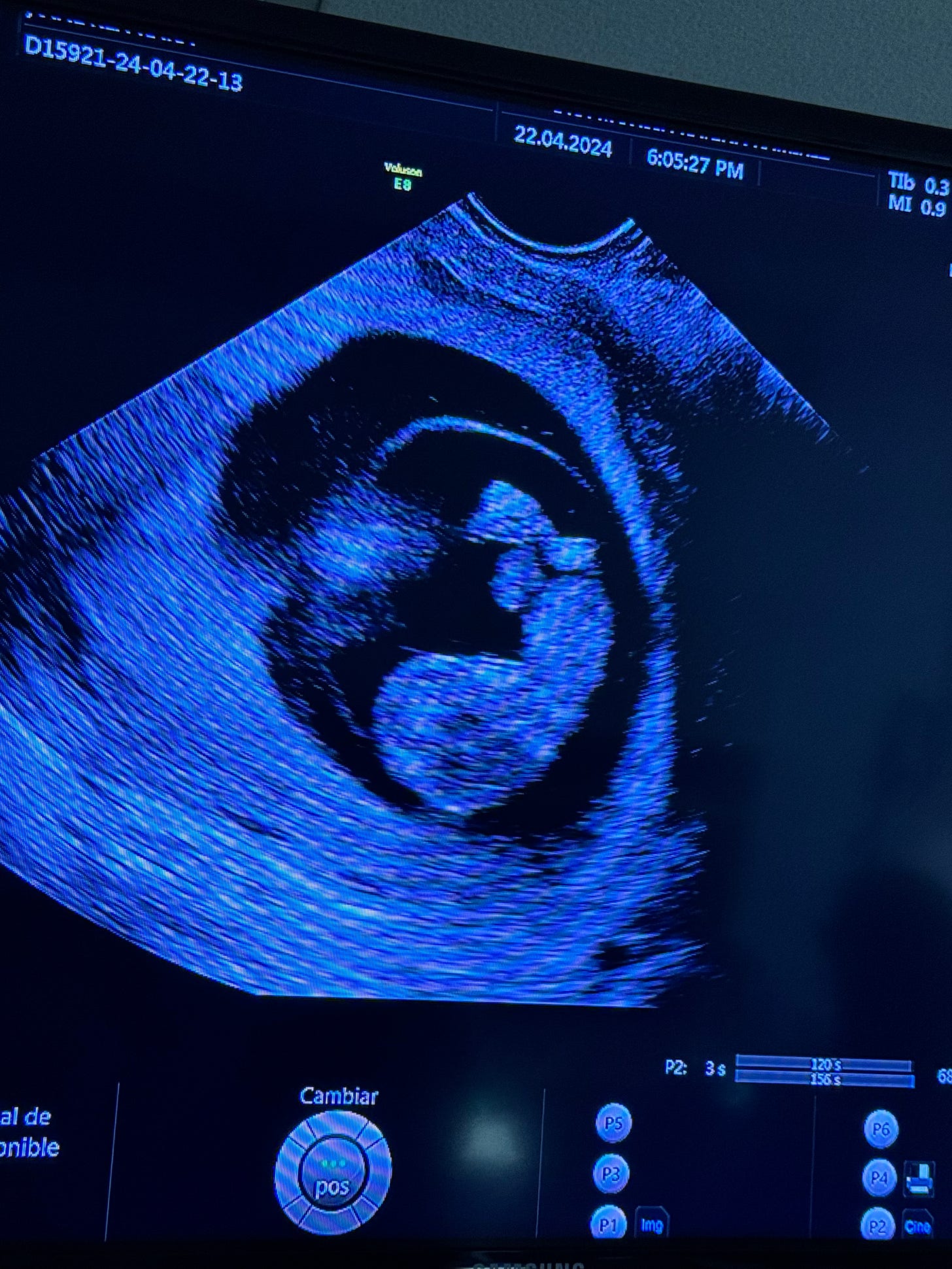 A photograph of an ultrasound.