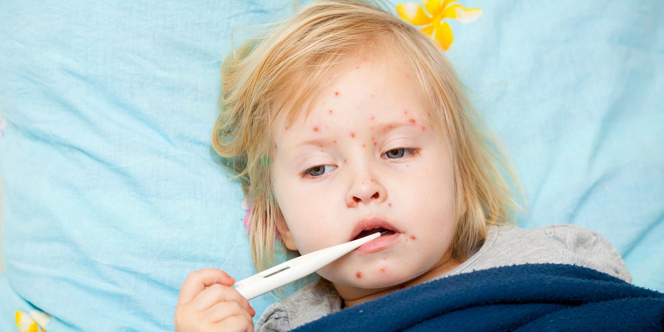 Measles and MMR vaccine resources