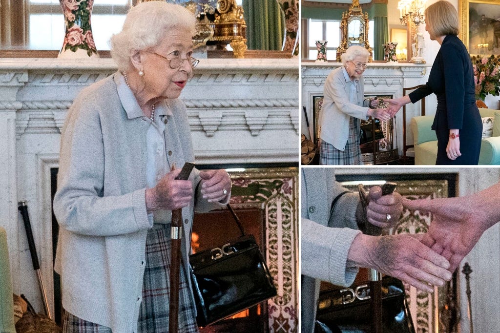 Royal watchers have expressed alarm over new photos that show the Queen sporting what appears to be a dark blue bruise on her right hand. The 96-year-old monarch's health has been in the spotlight in recent months. Royal watchers have expressed alarm over new photos that show the Queen sporting what appears to be a dark blue bruise on her right hand. The 96-year-old monarch's health has been in the spotlight in recent months.