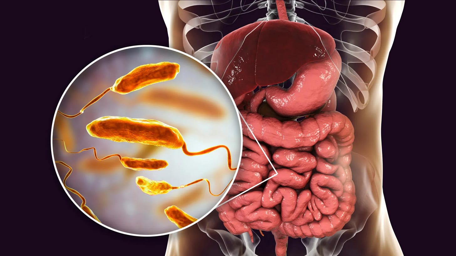 This diet could slash cholera infections by up to 100x | ScienceDaily