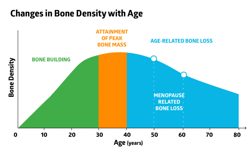 You Dense? I Hope Your Bones Are! | Weight Training & Bone Density