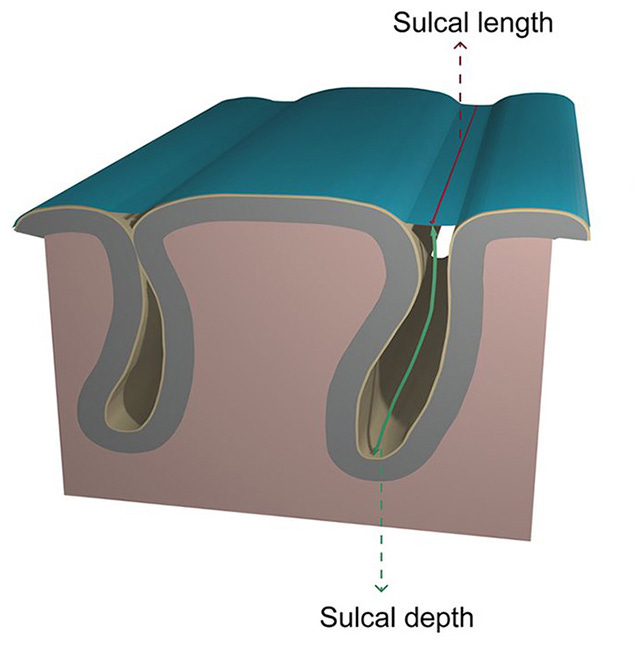 Sulcal depth diagram Sulcal depth diagram