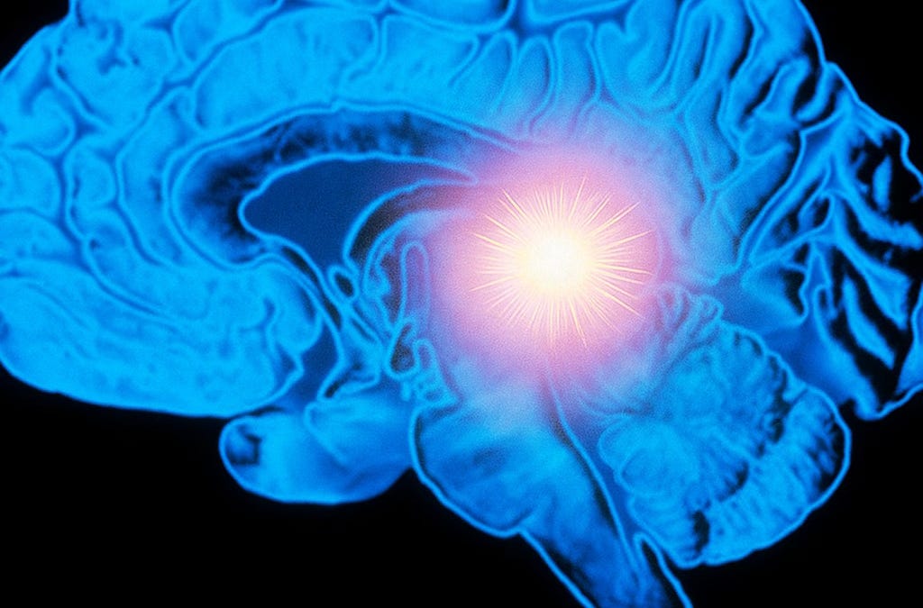 Stone Brain The Stone in Your Brain: How Modern Life Is Calcifying Your Pineal ...
