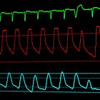Beta-blockers for septic shock (STRESS-L trial)