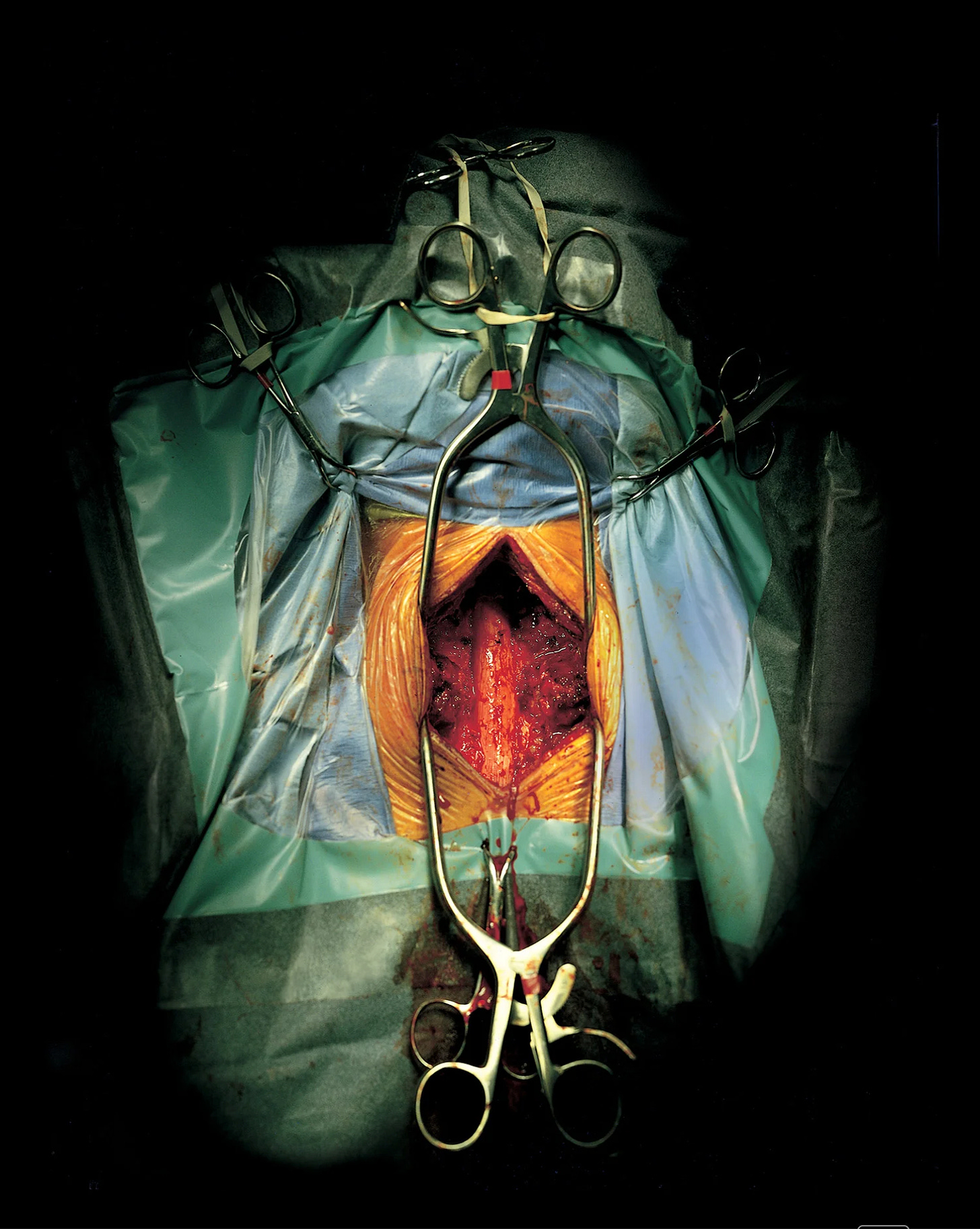 Photo of spinal cord from the book The Sacred Heart by Max Aguilera-Hellweg.