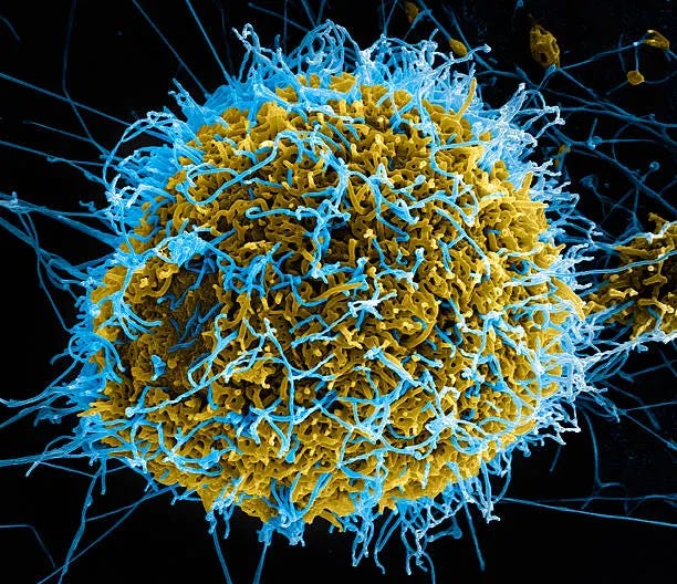 The Ebola Hoax Part 2