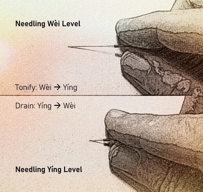 closeups of a hand holding an acupuncture needle. in the upper image the needle is inserted superficially at the wei level, and in the lower image the needle is inserted deeply to the ying level.