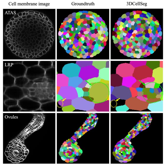 A novel deep learning-based 3D cell segmentation framework for future image- based disease detection | Scientific Reports