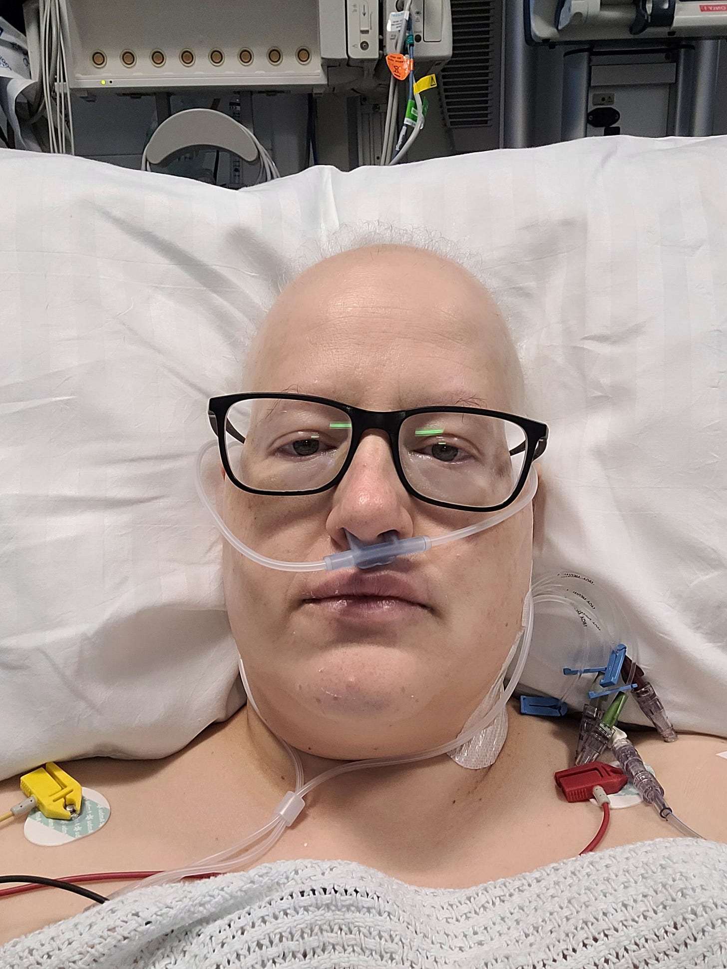 A photo of Stephanie, in a hospital bed. She is bald with dark glasses. There is one of those oxygen things under her nose and various tubes around her. She looks like she could be an extra on a medial drama or Star Trek 