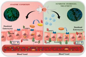 iron supplement infographic