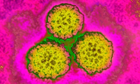 Scientists develop more accurate predictive test for cervical cancer | Cervical  cancer | The Guardian