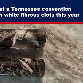 BREAKING: 64% of Embalmers at a Tennessee Convention Confirm They Have Seen White Fibrous Clots This Year 