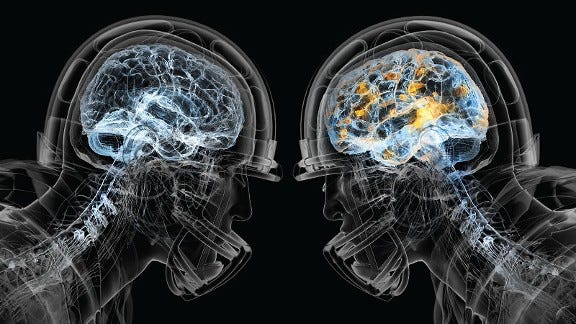 A Response to the Recent CTE Study - Brain Injury Association of MI
