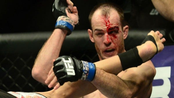 cole miller bloodied up cut from max holloway ends ufc fight night 60 20115 cole miller bloodied up cut from max holloway ends ufc fight night 60 20115