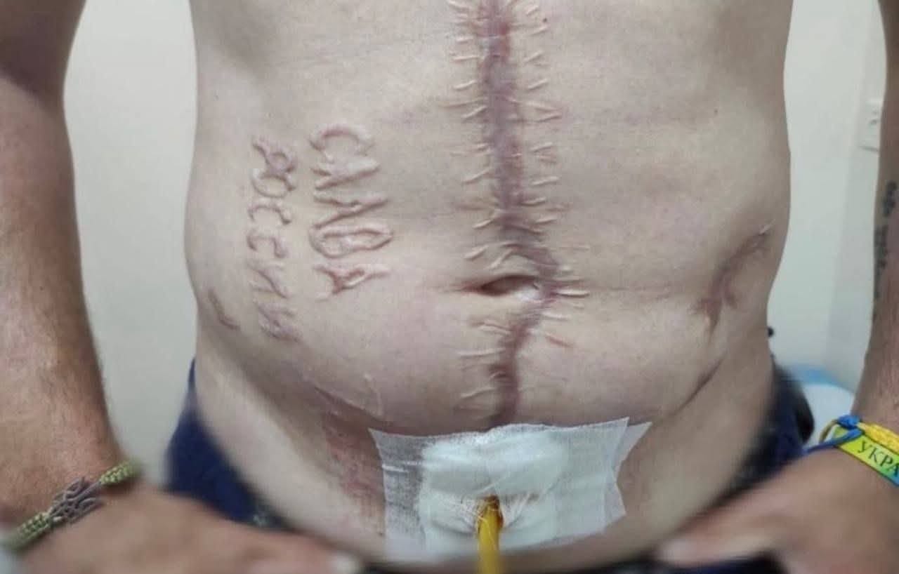 Plastic surgery to cover up war wounds