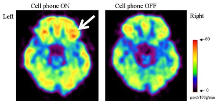 Wireless Radiation Impacts the Brain - Environmental Health Trust