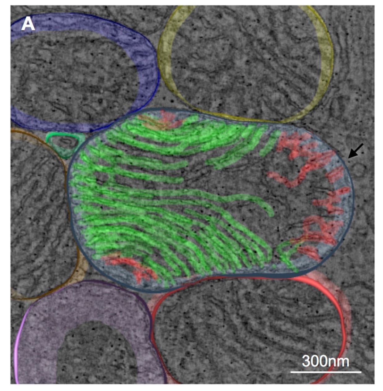 Nanometer resolution microscope image of the alignment of cristae within mitochondria.