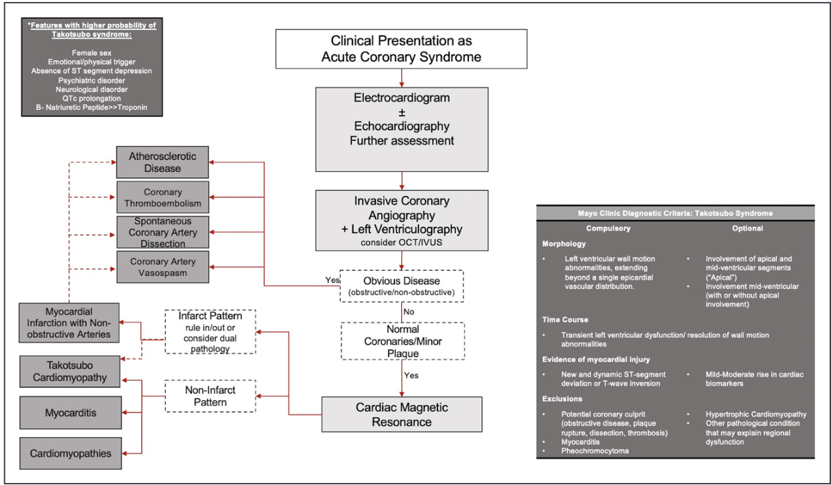 Quando Infarto Agudo Miocárdio Lateral Inferior Ocorre Simultaneamente  Eletrocardiograma Pode — Foto © asia11m #647541312, image size:1212x708