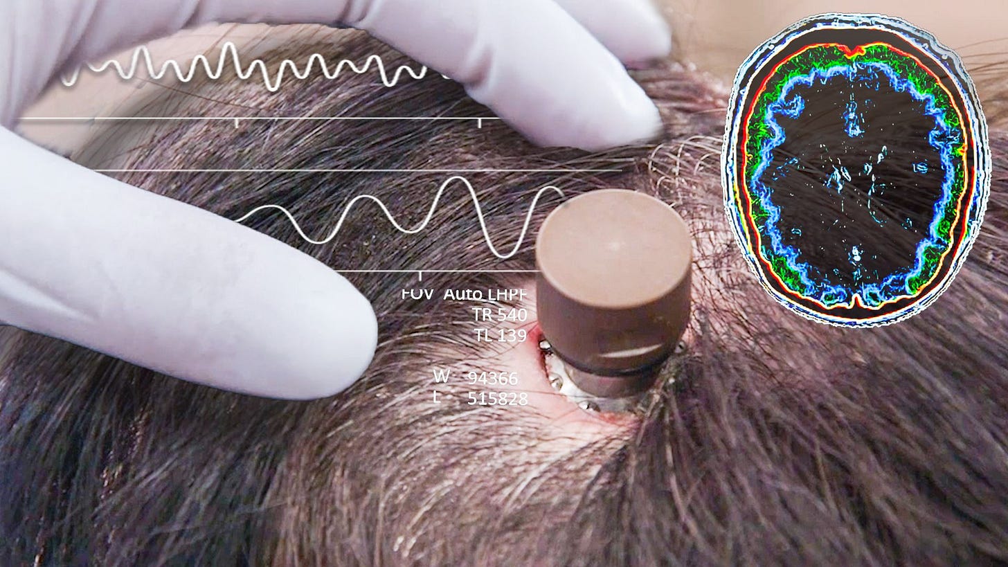 Watch The Science Behind Elon Musk's Neuralink Brain Chip | Currents | WIRED