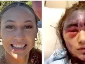 Michael Bryant: More to the Disturbing Story of Alexis Lorenze — A Medical Nightmare 