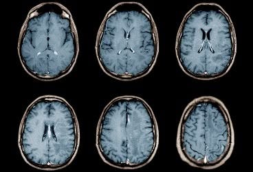 This may contain: six mri images show the different areas of the brain, including one in blue and four in white