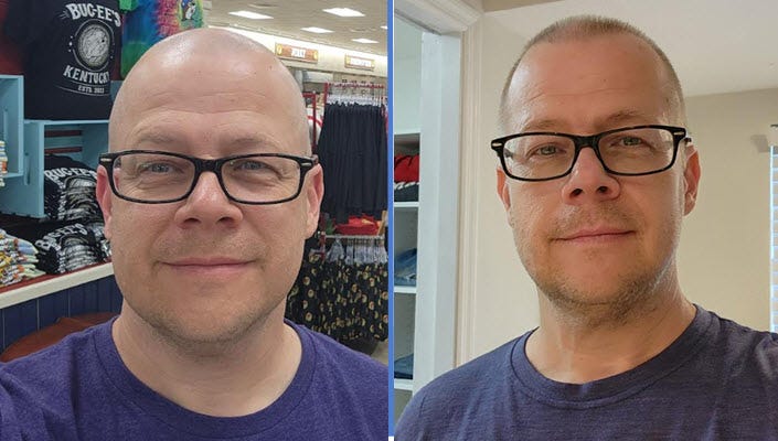 Before and after: Left, Allen 18 pounds heavier than on the right