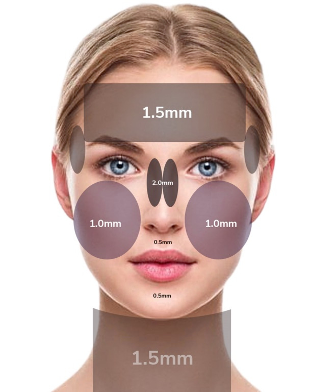 Radiofrequência Microagulhada na Harmonização Facial