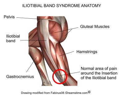 iliotibial-band