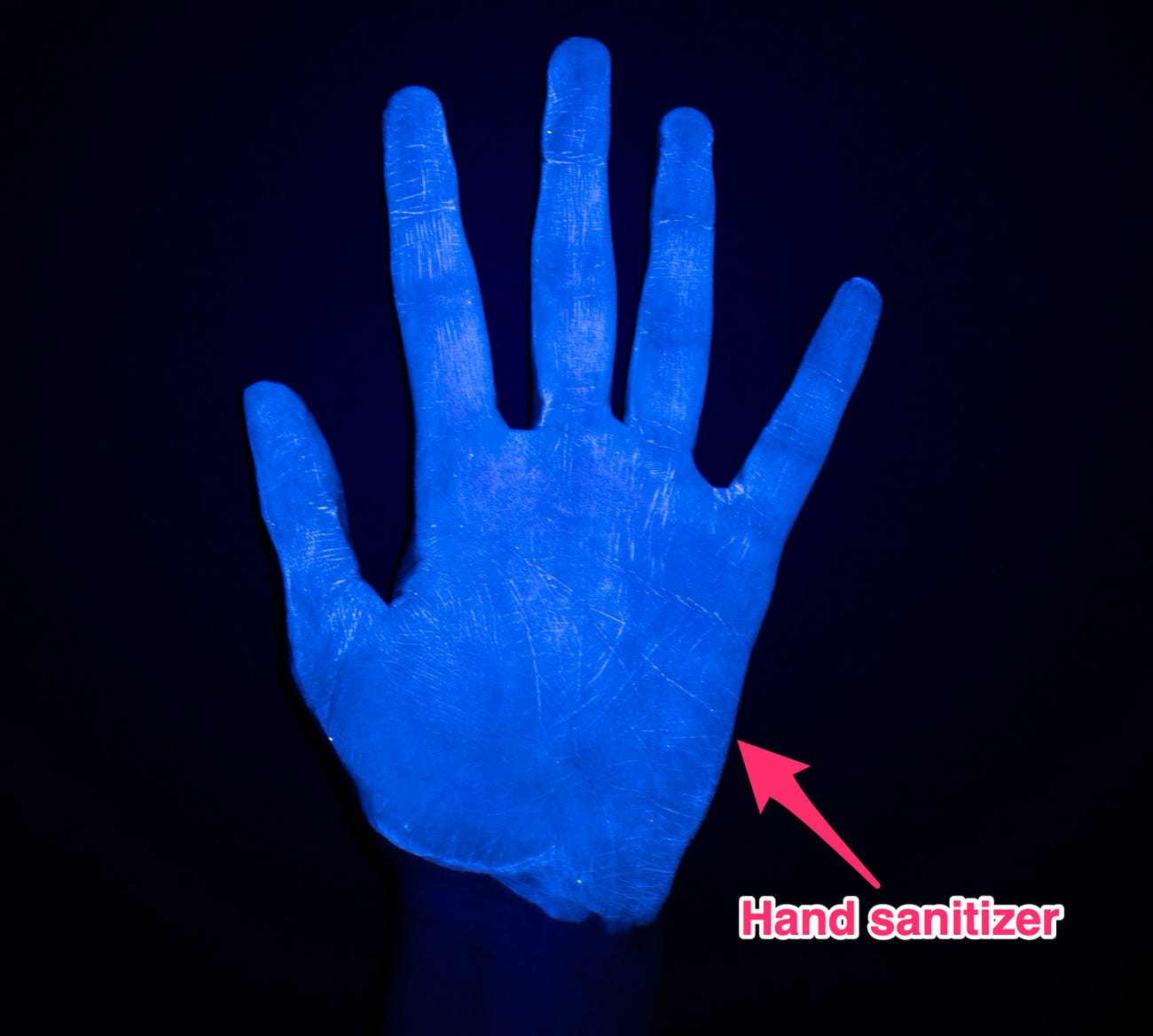 Hand cleaned with hand sanitizer Hand cleaned with hand sanitizer