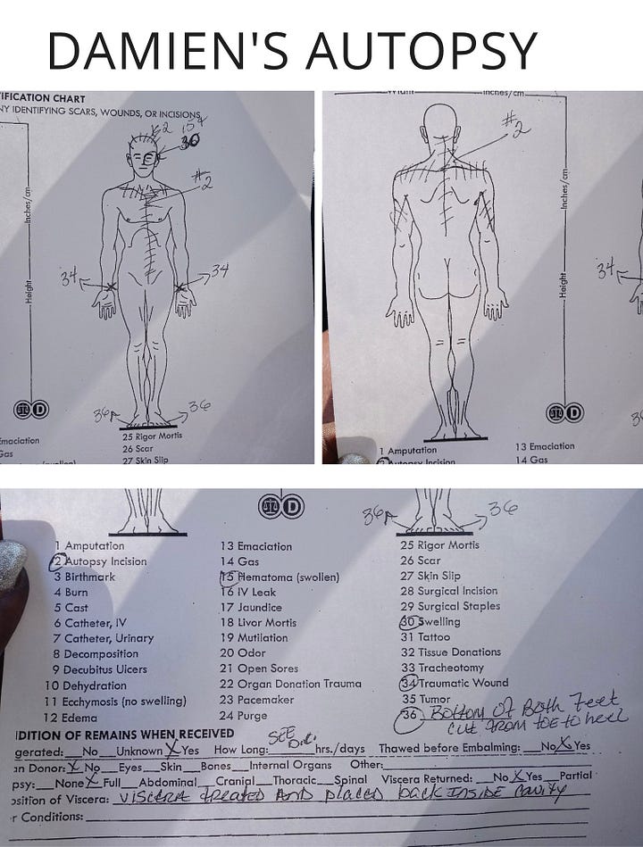 Autopsy findings courtesy of Clorissa Wright