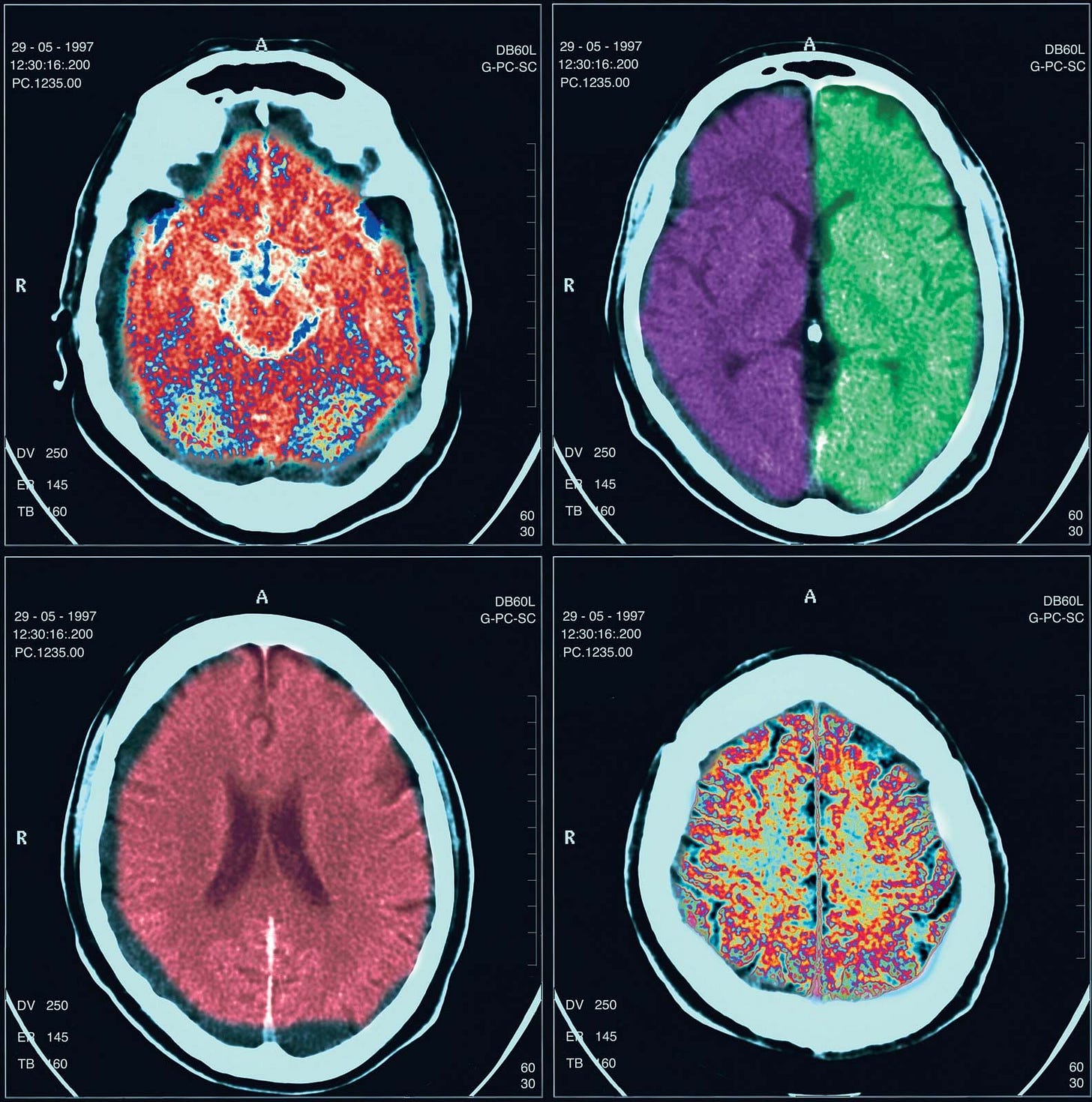 Advanced Brain Imaging and AI-Driven Drug Discovery: A New Frontier in ...