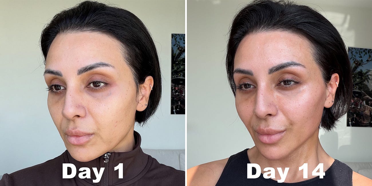 Why No One Believes I’m 45…How The ZIIP HALO 2.0 Took 10 Years Off My Face