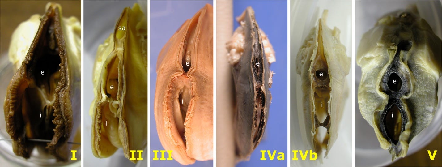 Comparative photographs of the posterior apertures of freshwater mussels of each type